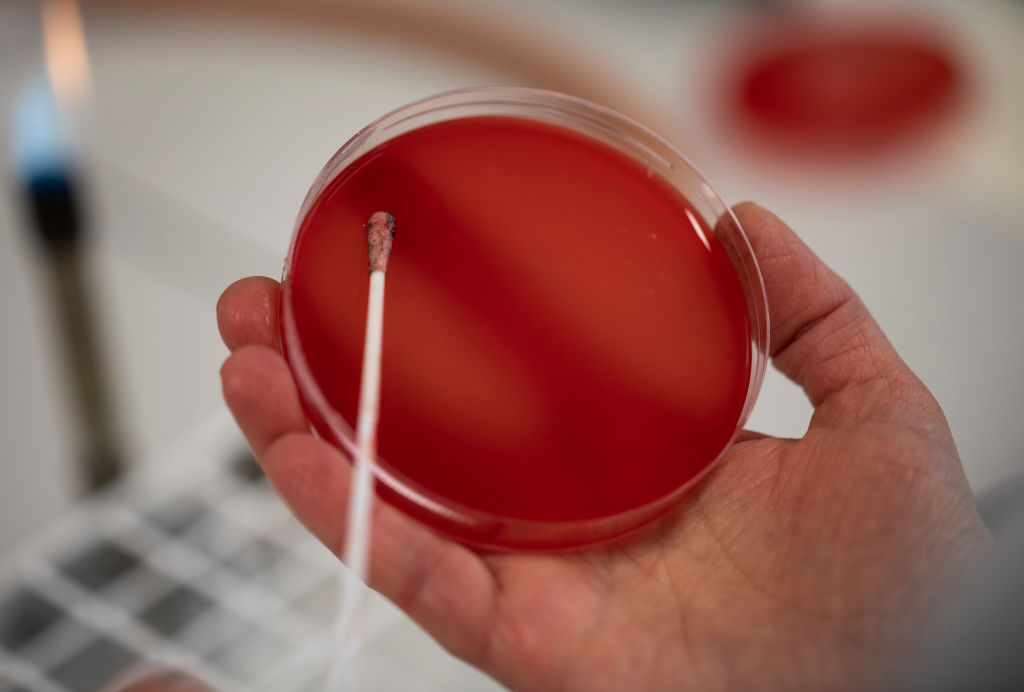 GettyImages-1097919816 A lab technician swabs out a blood Agar plate bacteriology sample