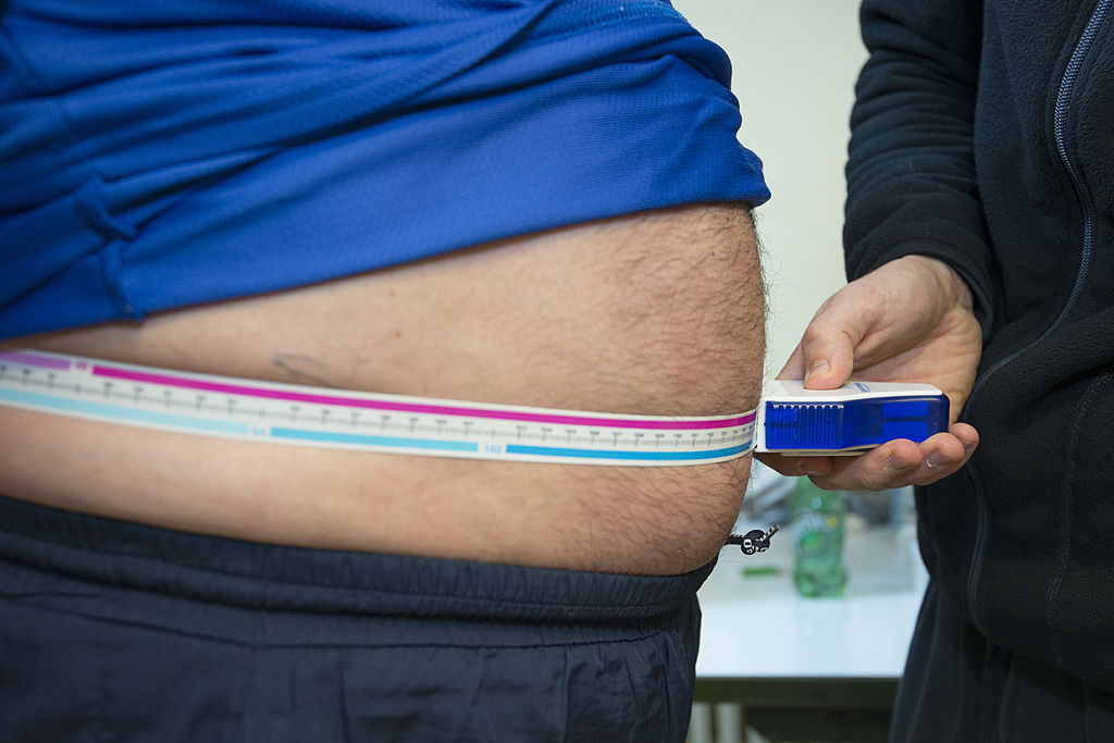A man's large gut is exposed under his shirt as someone measures his waist