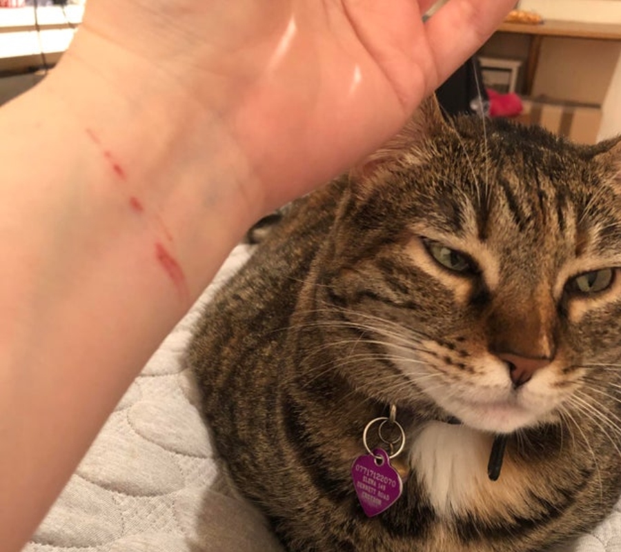 cat scratching person on wrist