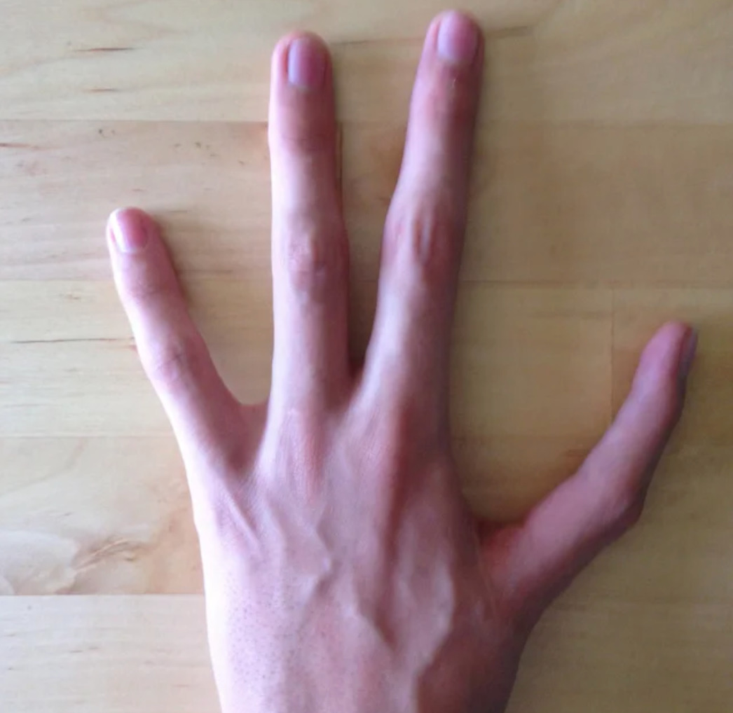Person has four fingers