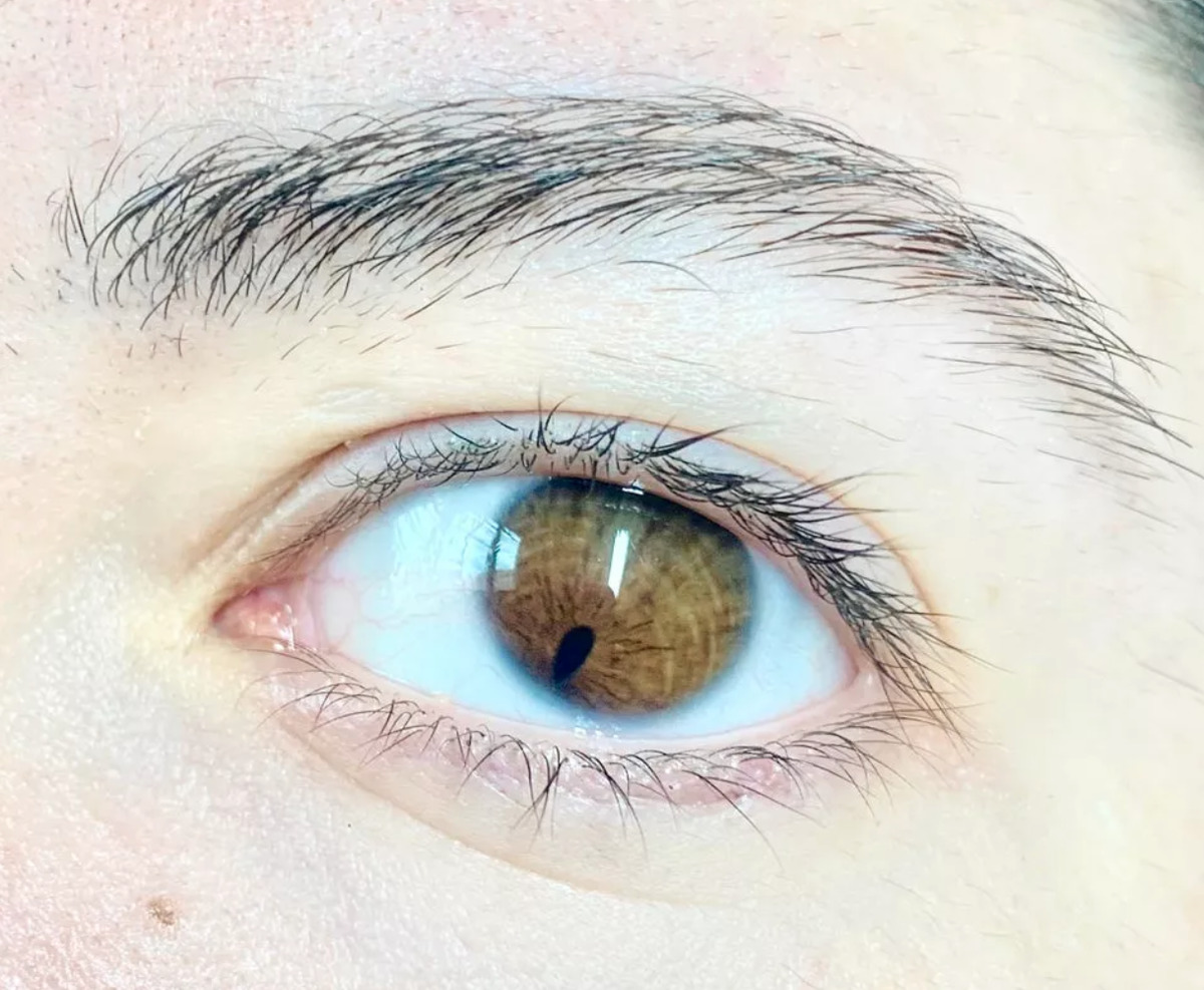 eye has pupil super low