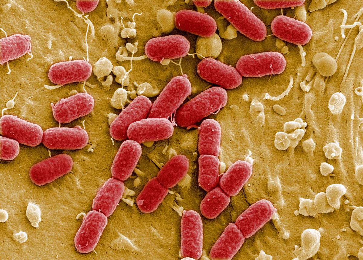 bacteria under electron microscope