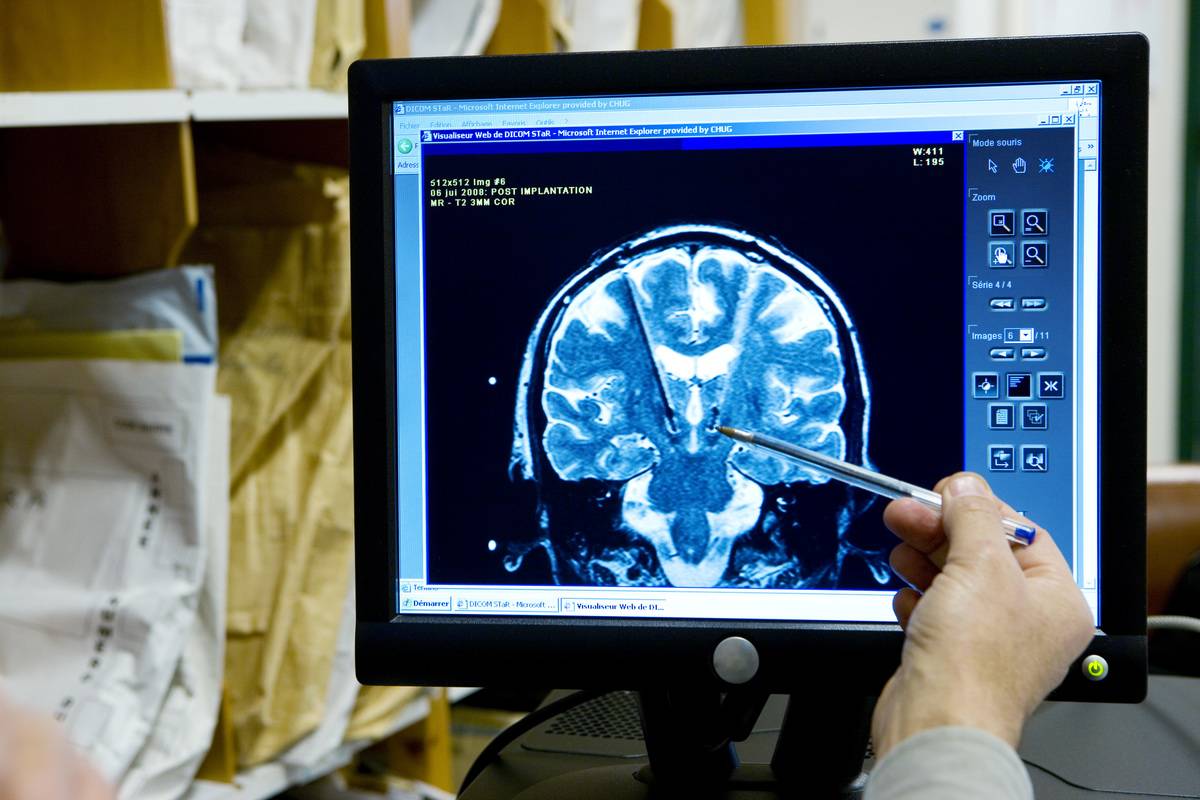 scan image of brain