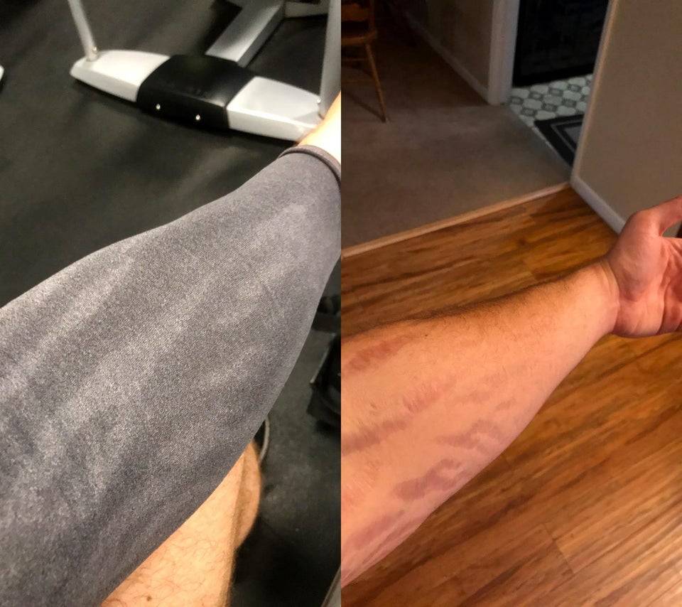 sweat on shirt where there's no scars