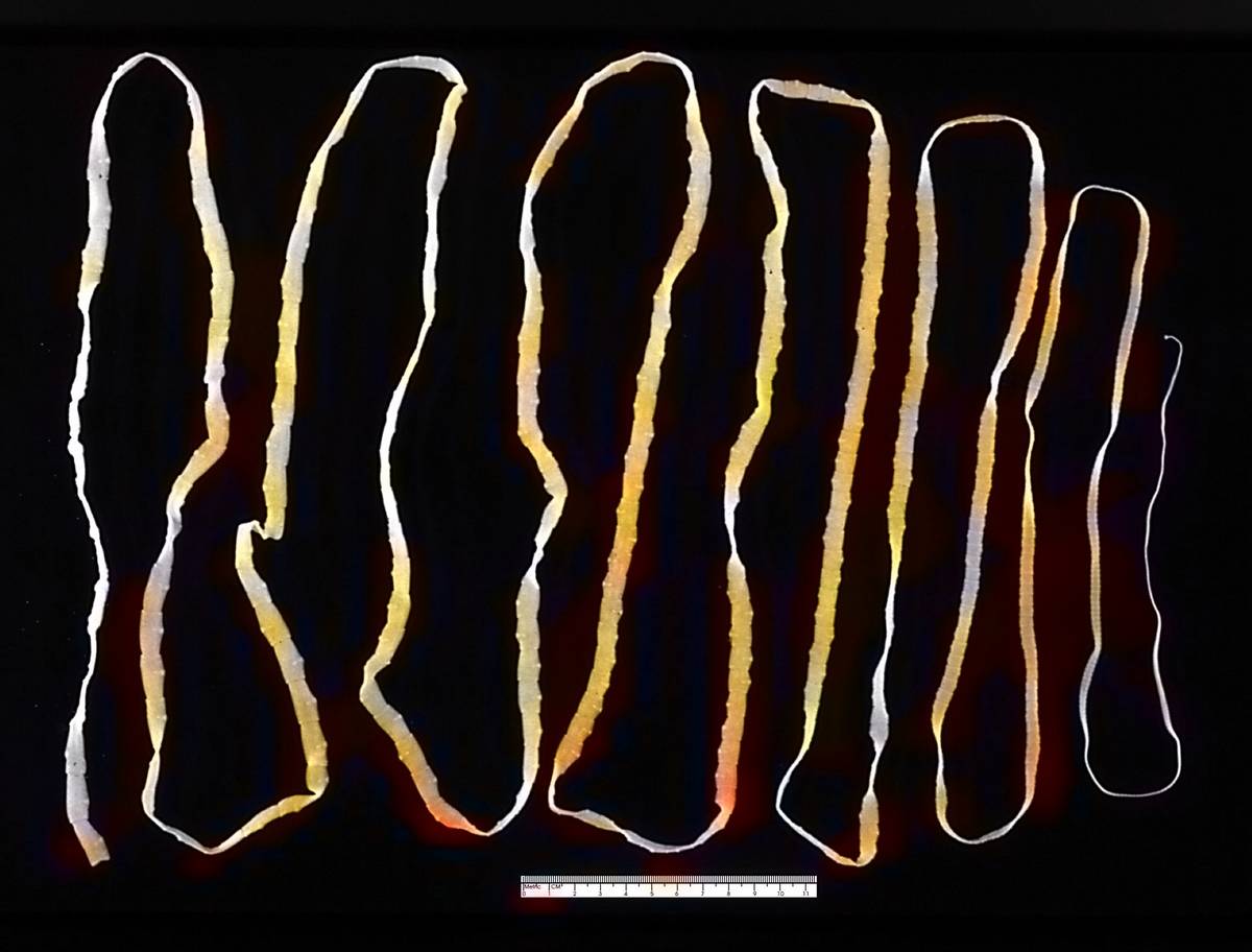 Adult tapeworm (Taenia saginata) removed from the human intestine, 1986