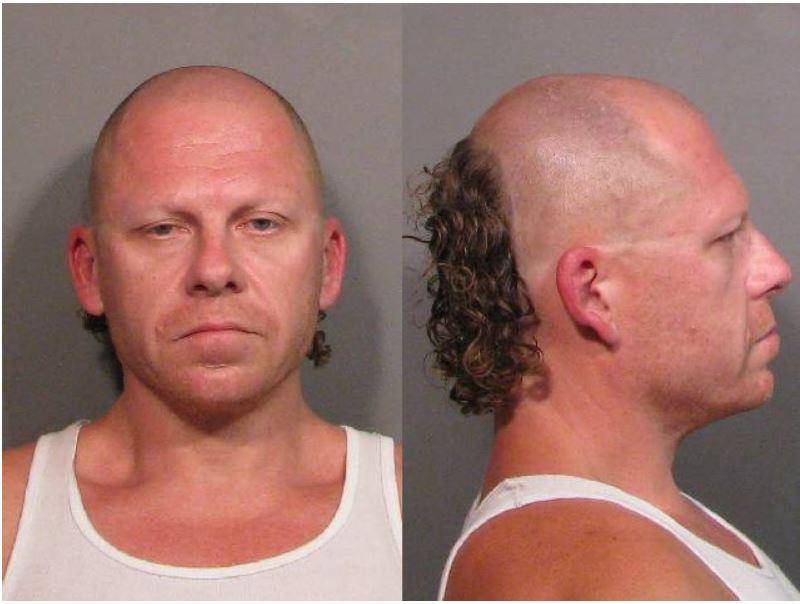 man has hair only in the back