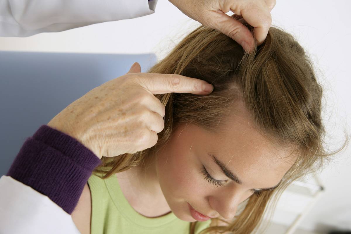 A doctor investigates a woman's hair for dandruff and lice.