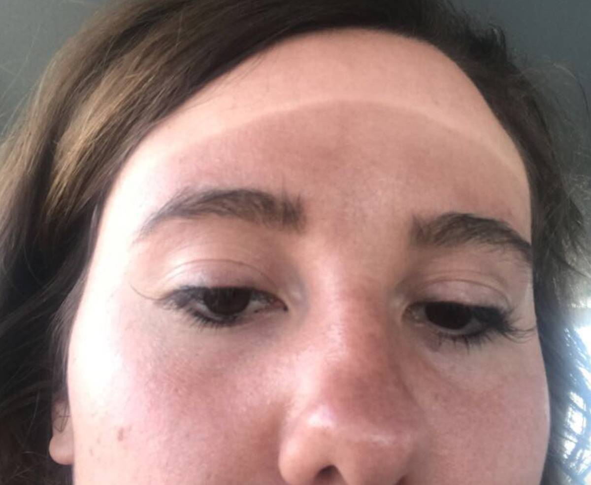 a person with a spray tan line on their forehead 