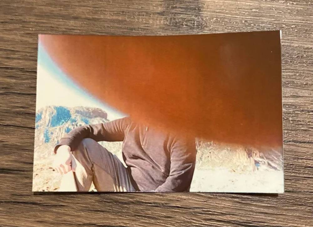 photo is mostly covered by thumb of taker