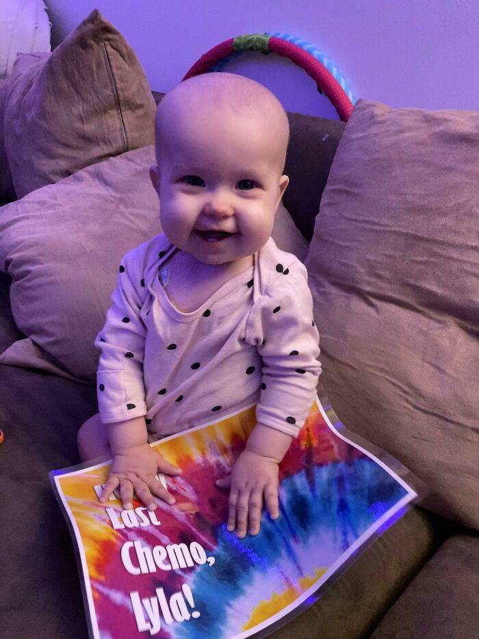 baby girl done chemo