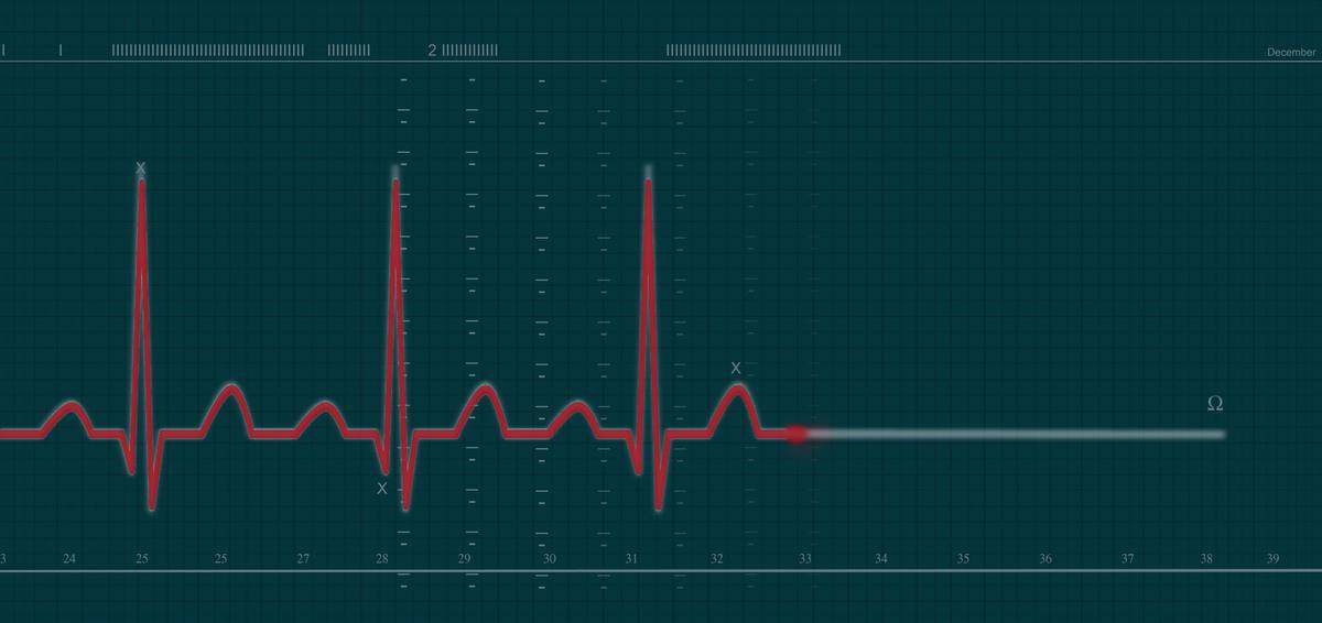A heartbeat appears on a machine.