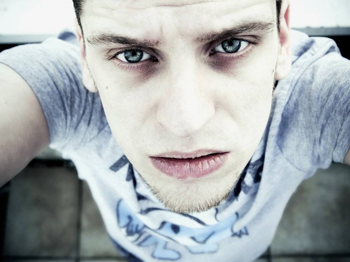 A man with a pale face looks up at the camera. 