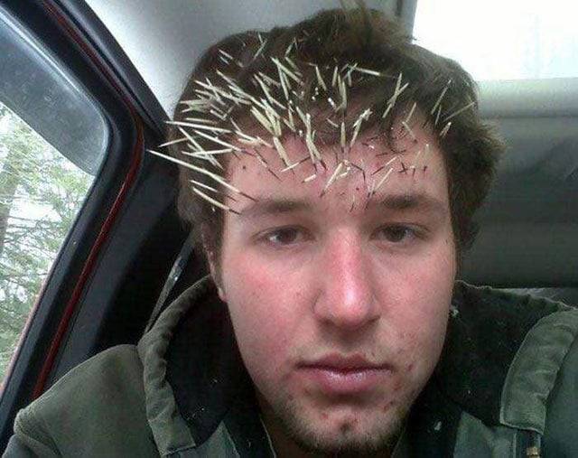 man with porcupine quills in face