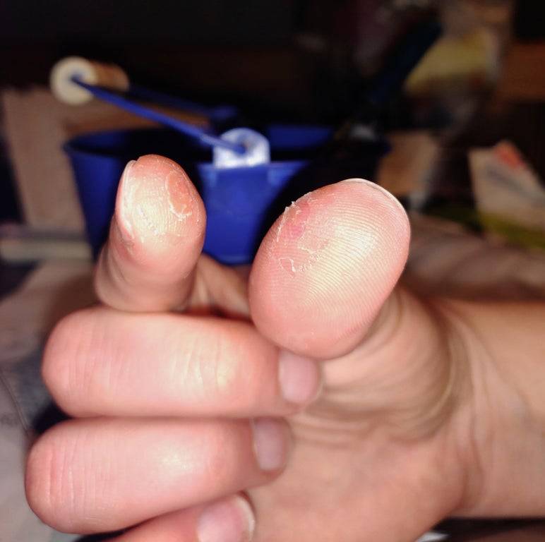 instant glue fail messed up his fingers