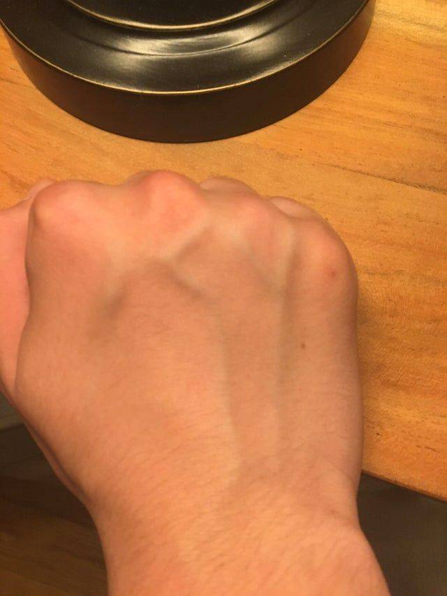veins in hand
