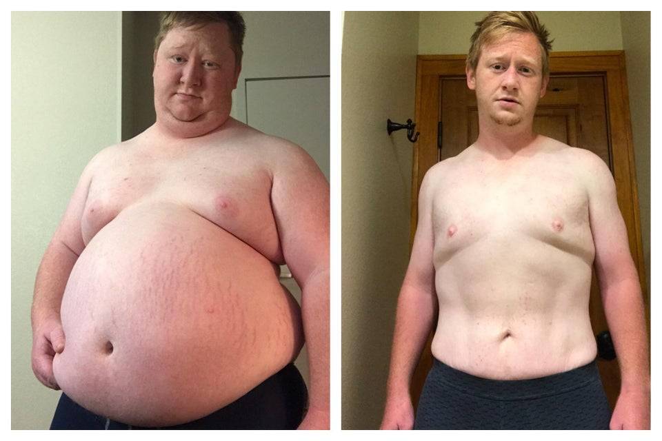 Young man in before-and-after pictures of 200 lb weight loss