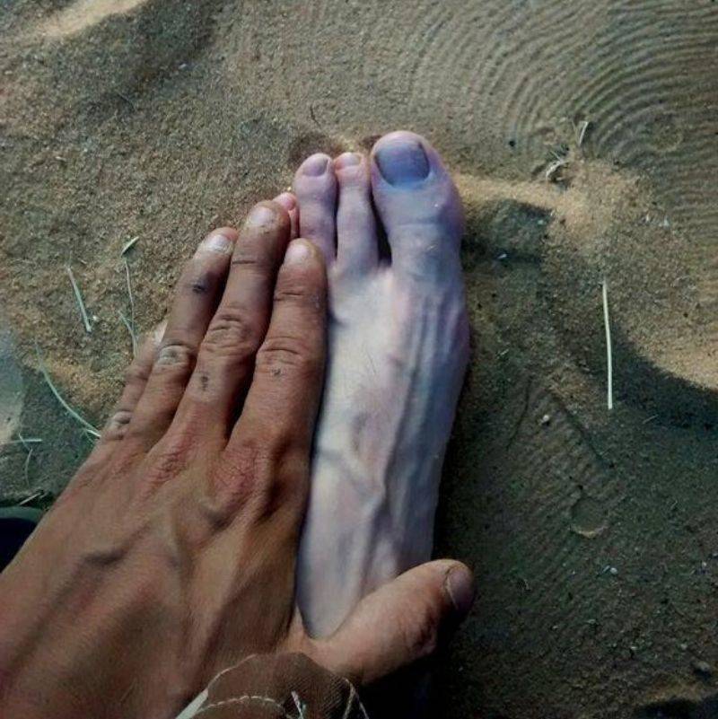 the difference between someone's tan on hand versus pale foot`