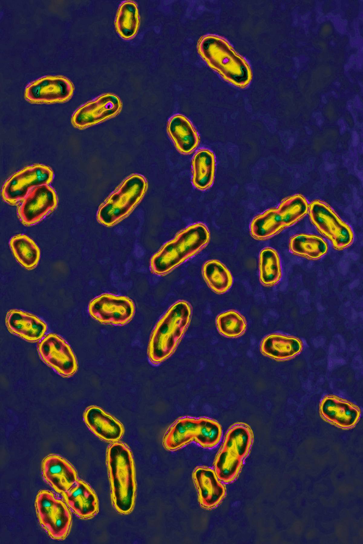 The bacteria Yersinia pestis is seen through a microscope.