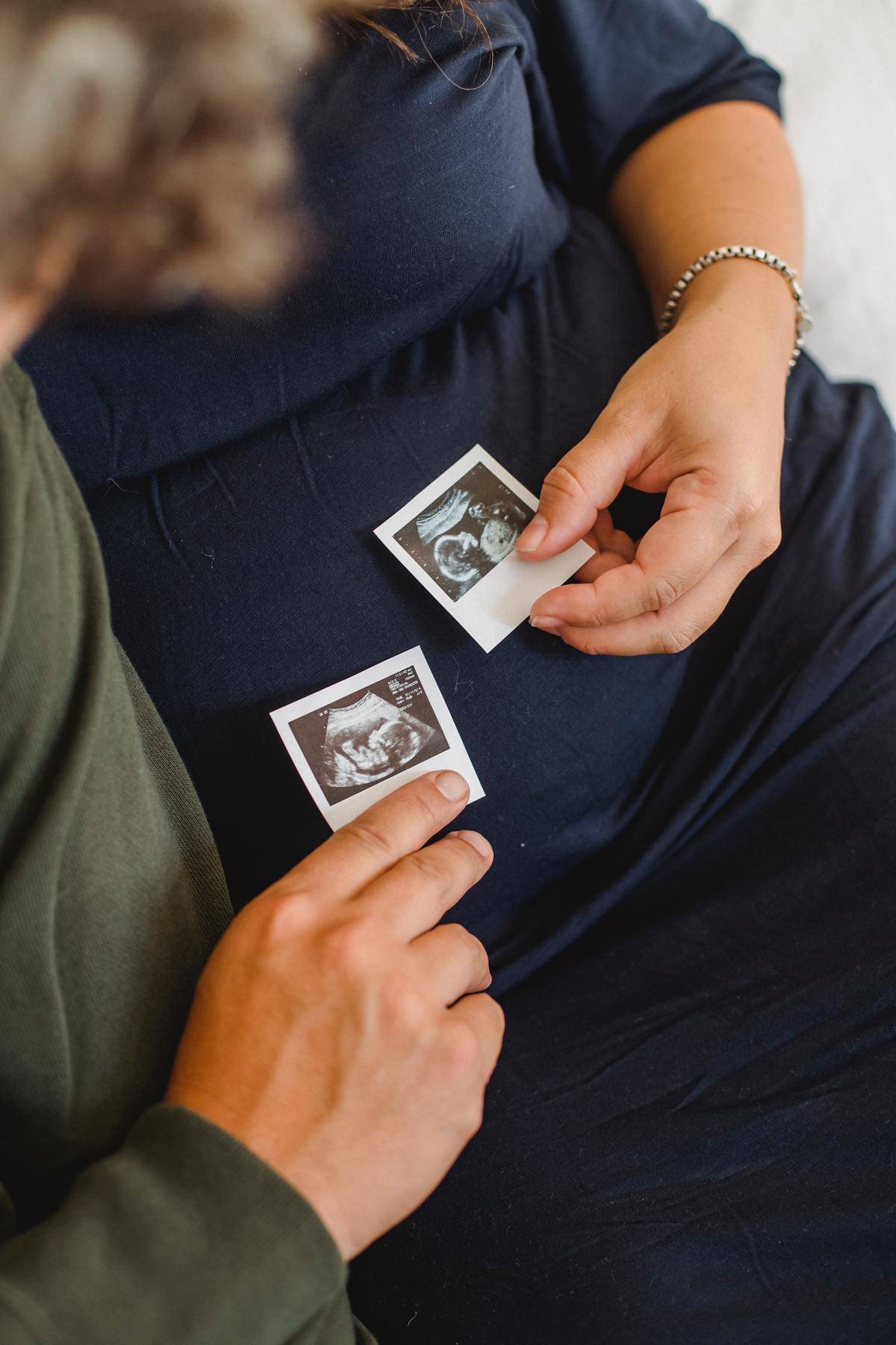 Man and woman hold ultrasound photos of their unborn baby
