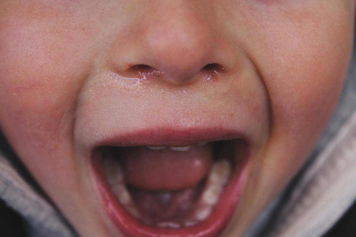Close-up photo of a crying child.