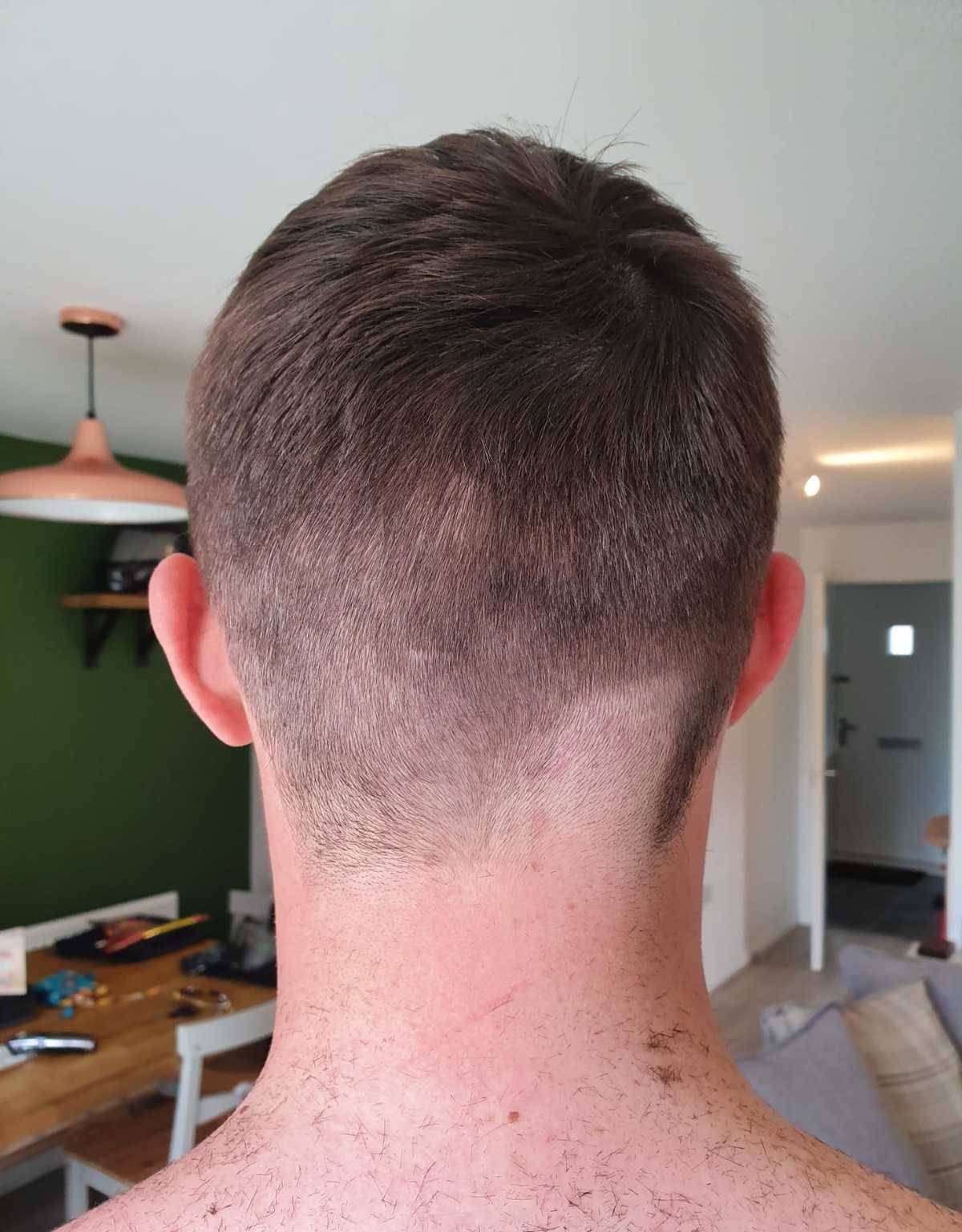 Back of man's head showing haircut uneven in one spot