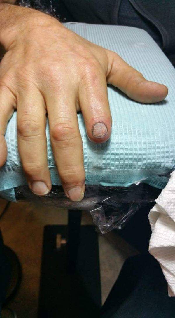 tattoo artists fixes stub