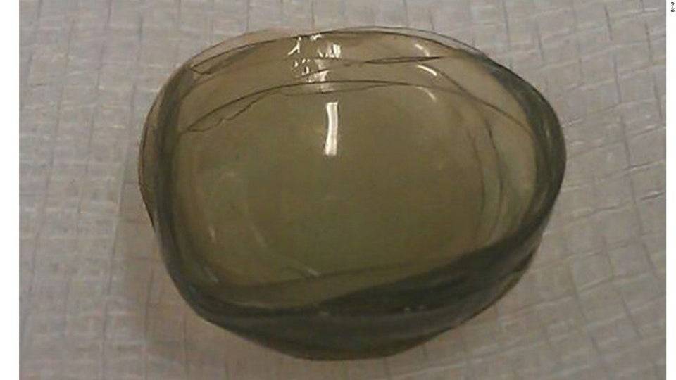 27 contact lenses stacked on top of each other.