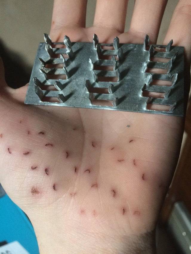 Scarred hand holding a gusset plate