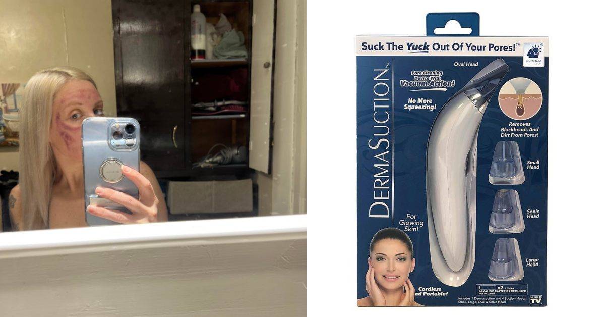 pore mistake on woman