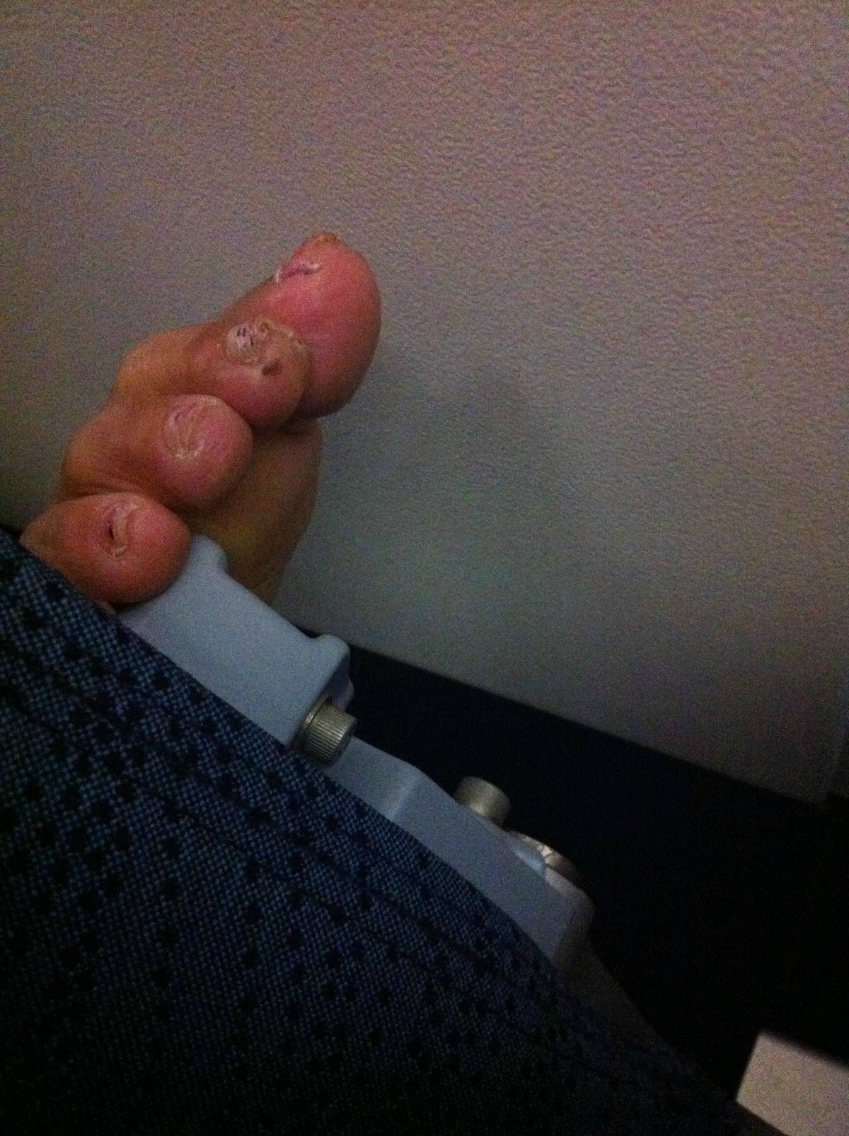 Person's nasty barefoot toenails sticking through the seat on an airplane