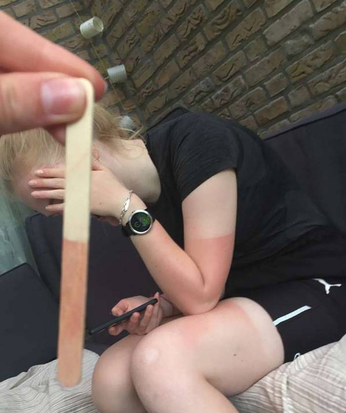 funny-sunburned-people-7-5f27b0766d60c__700