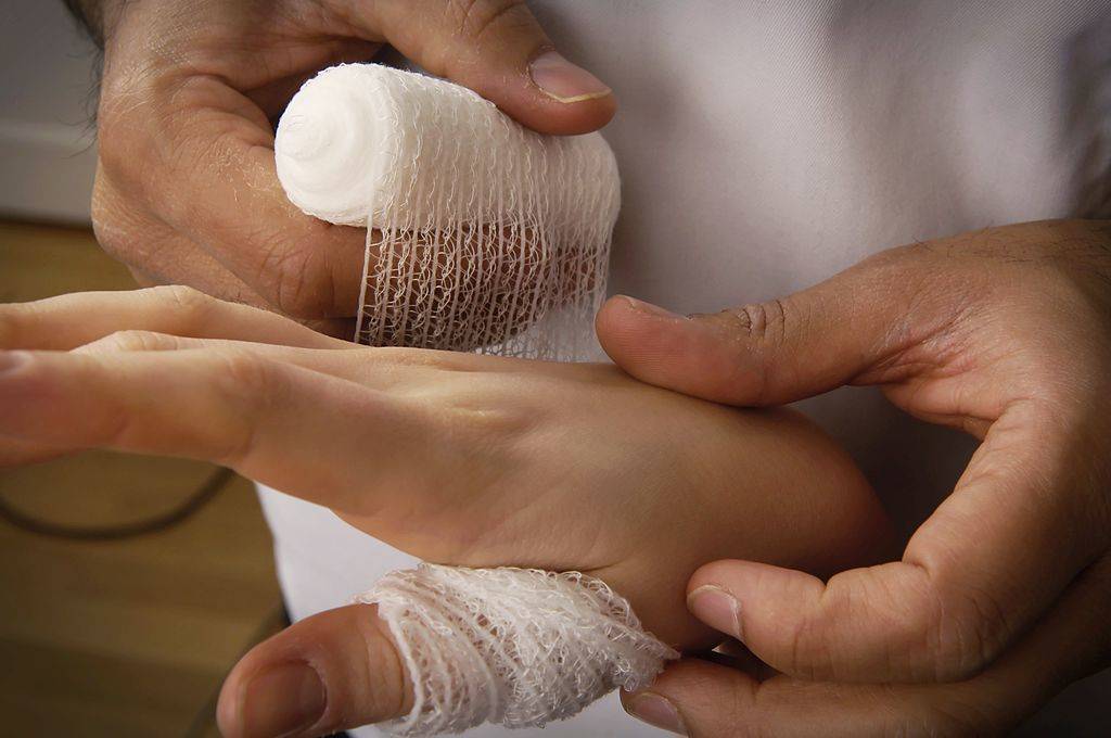 Doctor applying bandage to patients hand and wrist