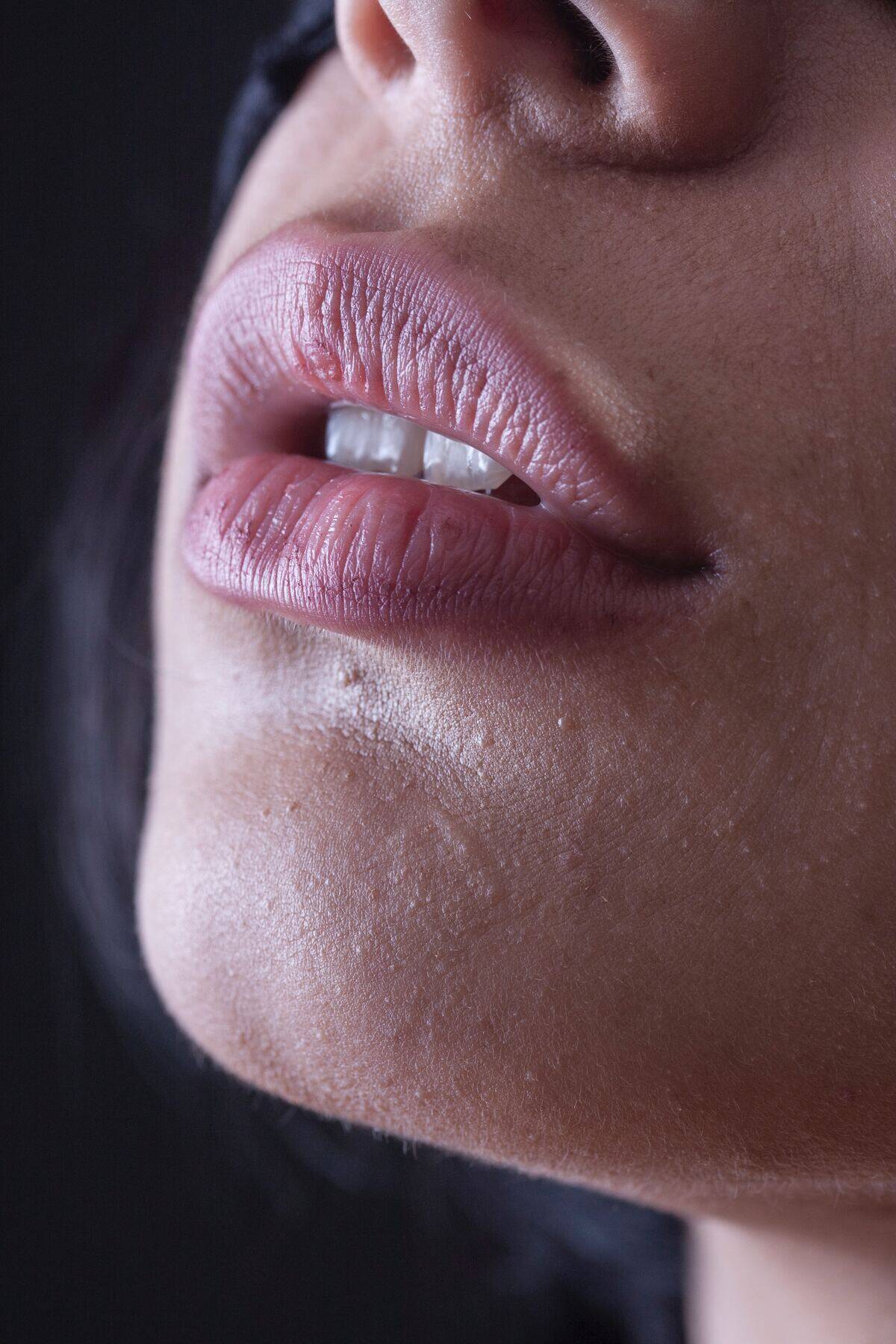 Lips