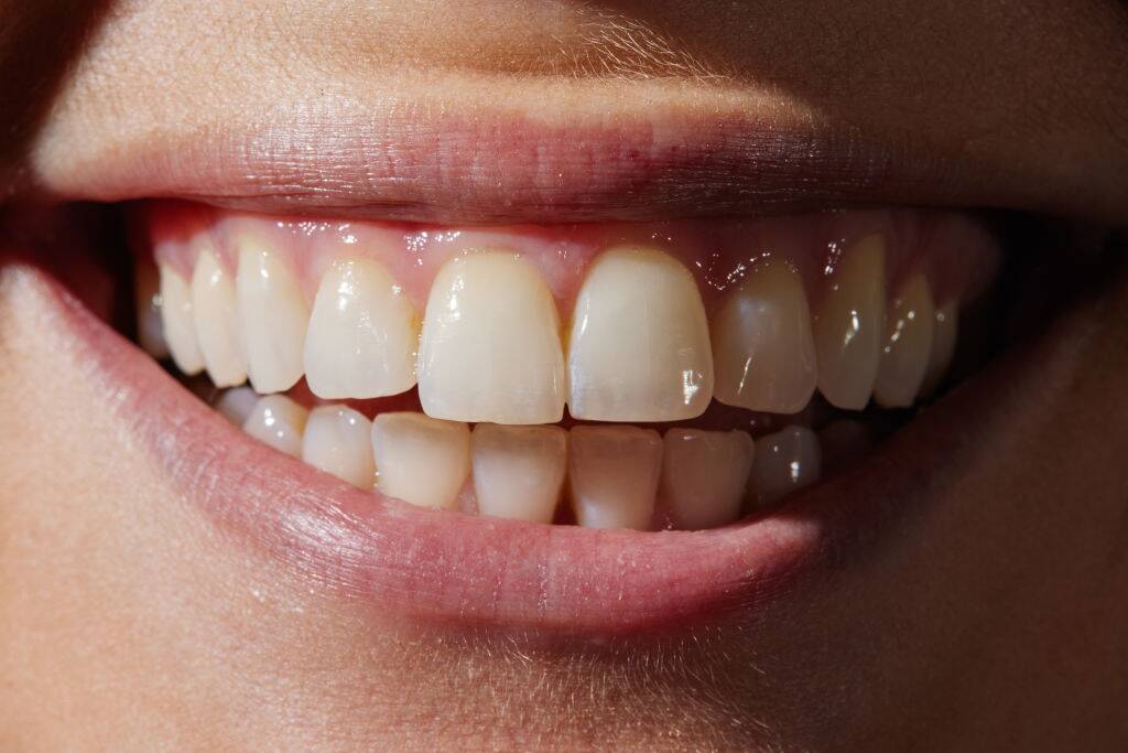 Teeth