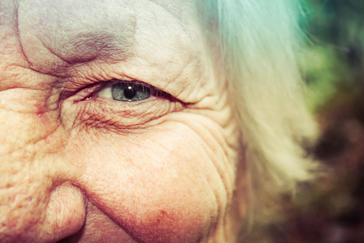 Wrinkles