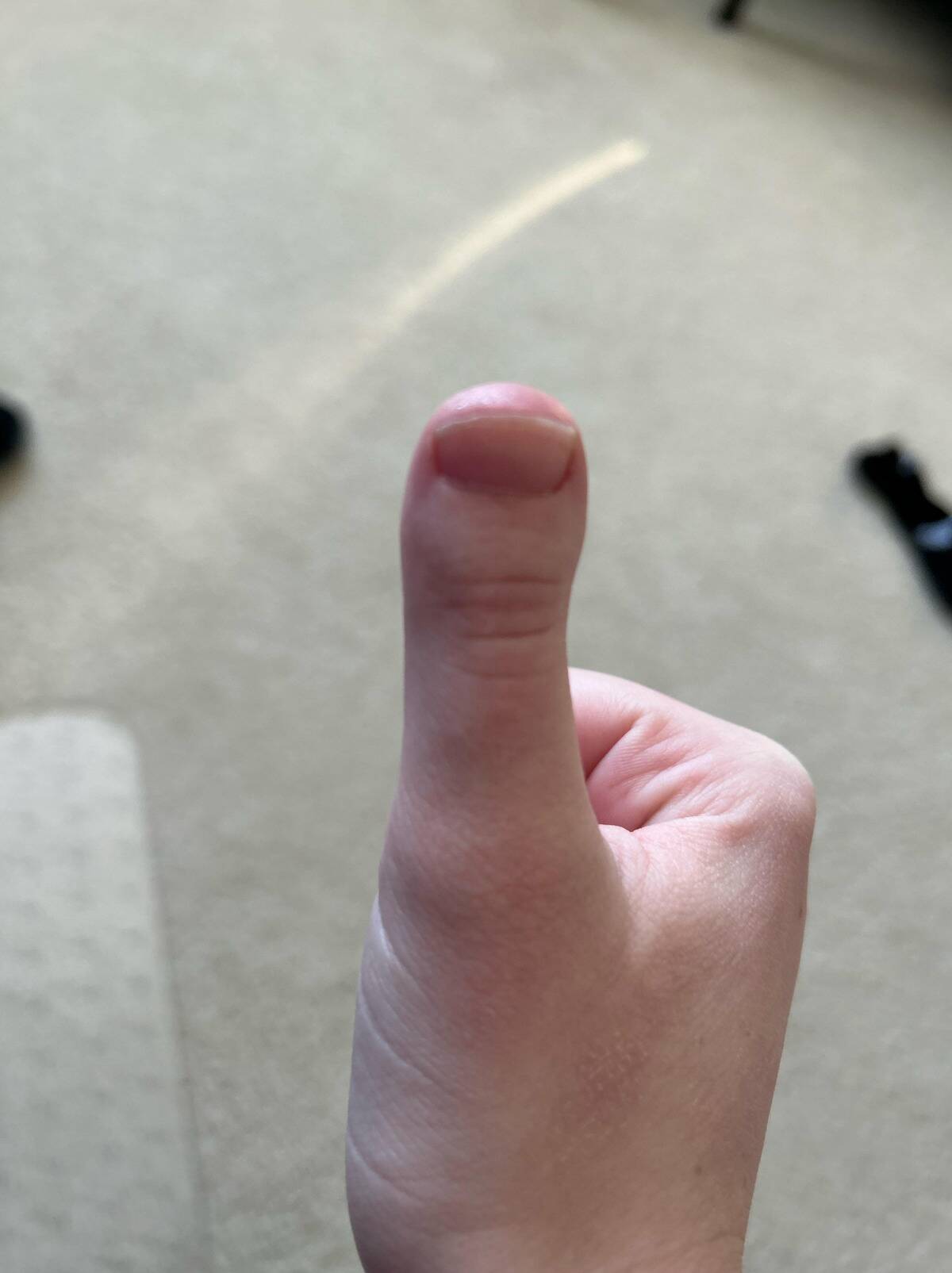 thumb