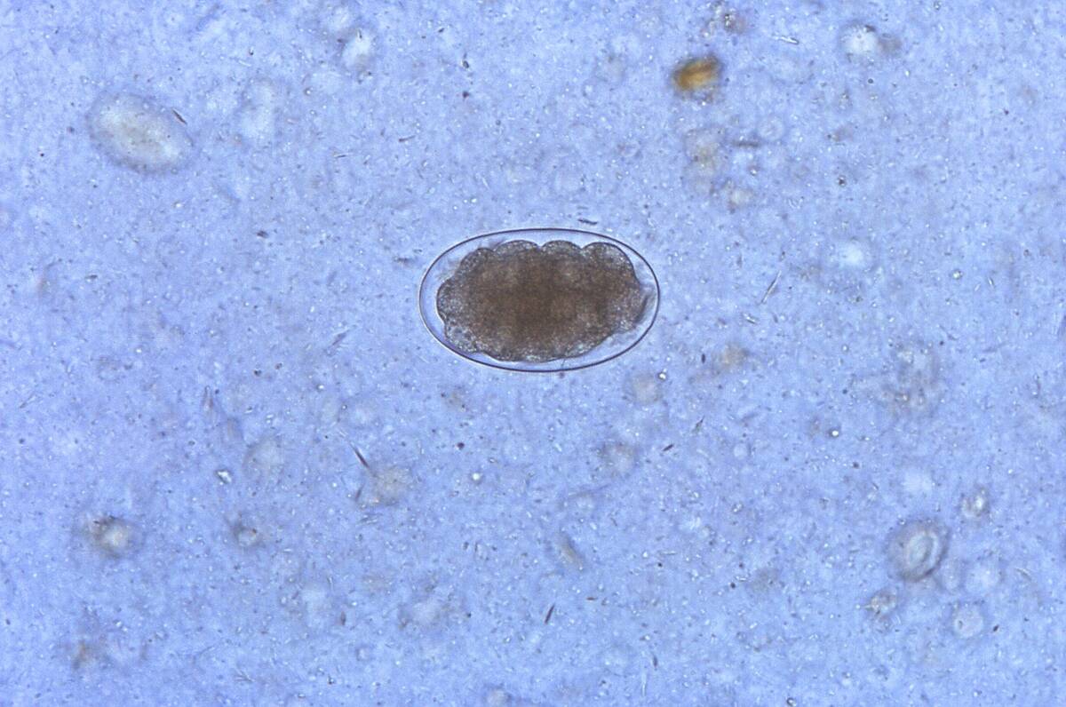 Hookworm Eggs