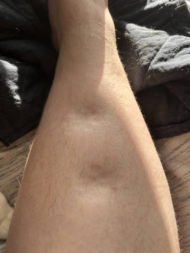 my-cat-stood-on-my-leg-and-left-paw-imprints-v0-jcqbwpvwsz9e1