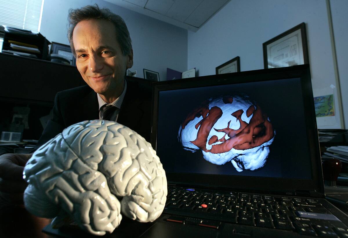 Dr. Gary Small, 57, a UCLA neuroscientist, is photographed next to a plastic model of the human bra