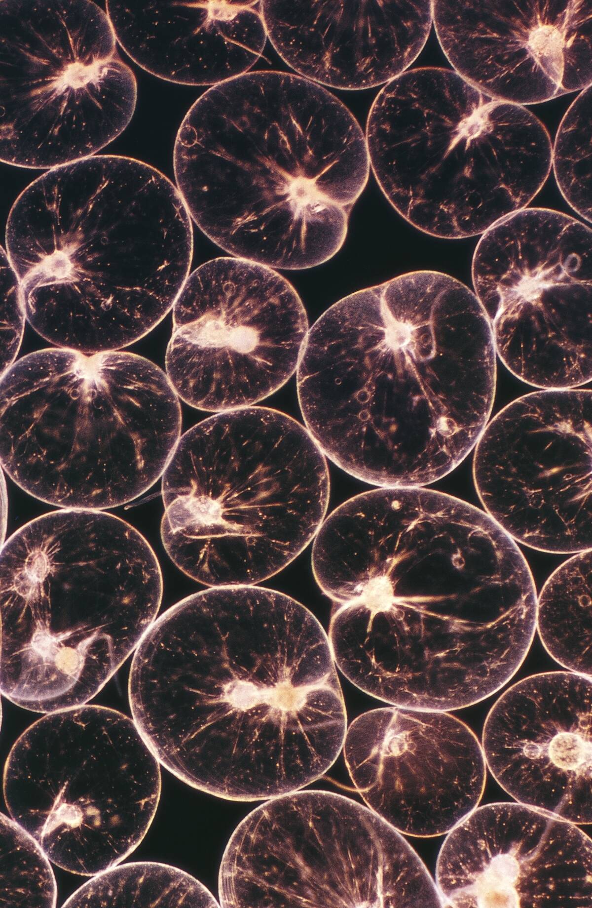Microphotograph of noctiluca scintillans...