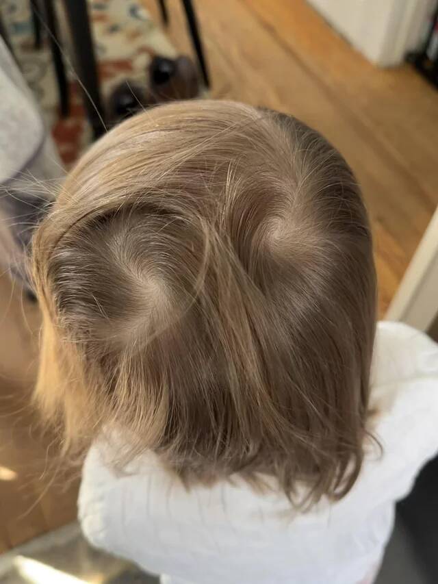 my-daughter-has-no-idea-about-the-lifelong-battle-she-will-v0-y07sl1zj10hg1