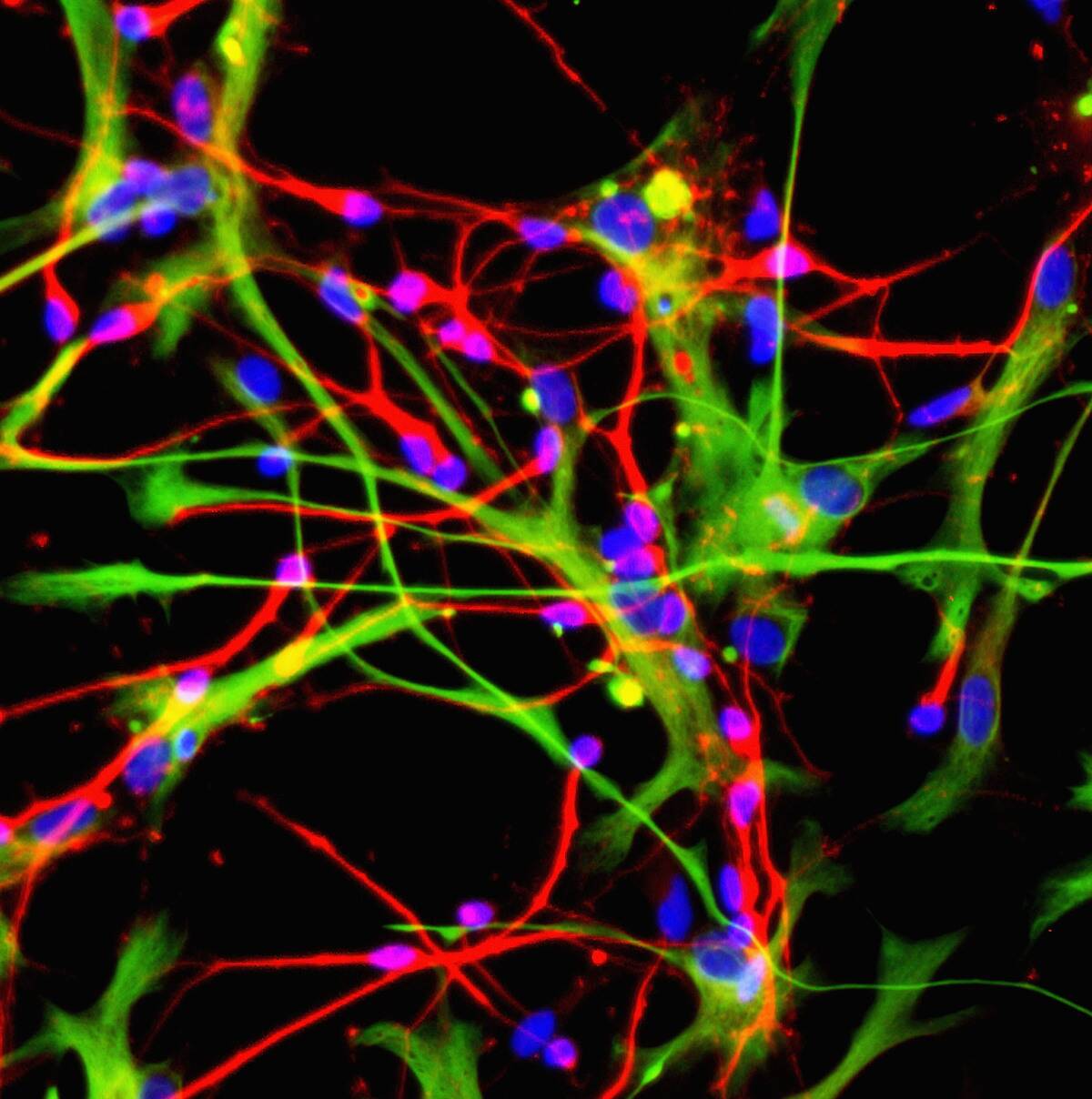 Stem Cells Open Doors To Greater Understanding Of Neurlogical Diseases