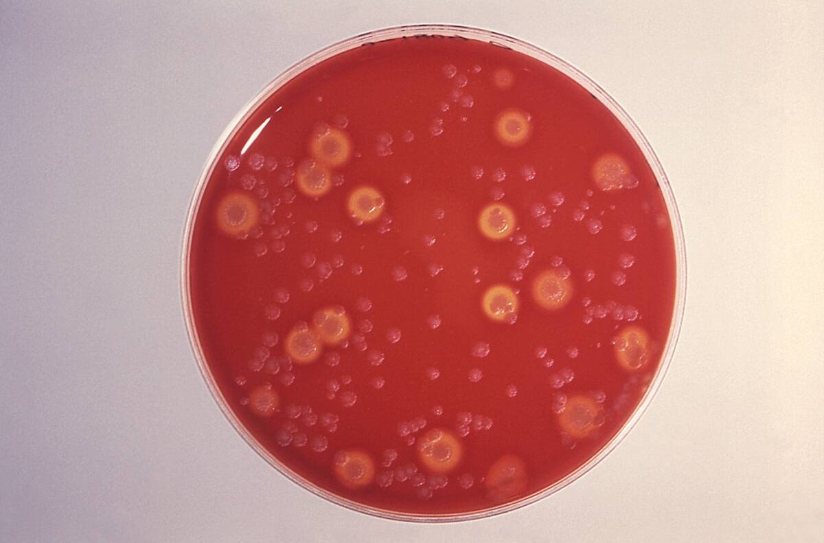 Bacillus Anthracis