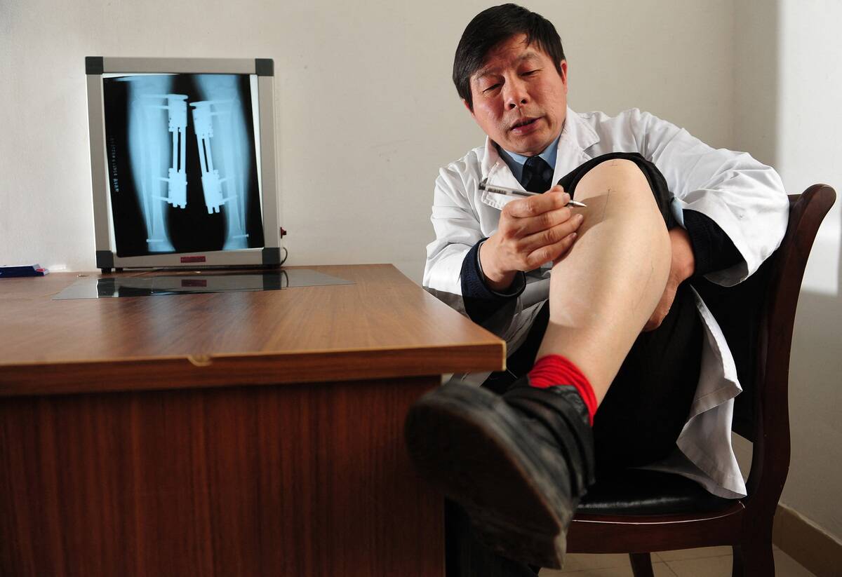 CHINA-HEALTH-LEGS