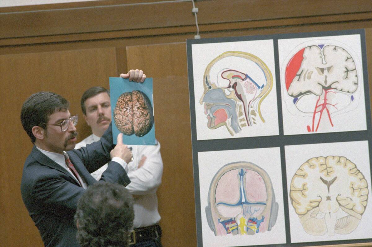 Douglas Miller Displaying Head X-Rays