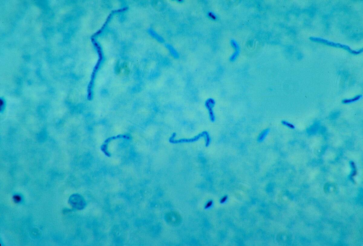 Fusobacterium Necrophorum
