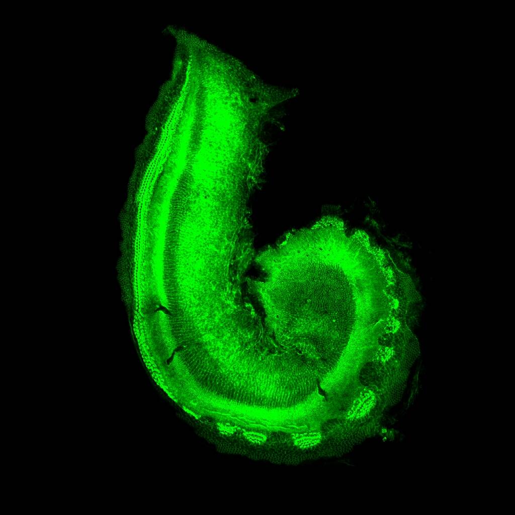 Cochlea_showing_hair_cells_(18598699365)