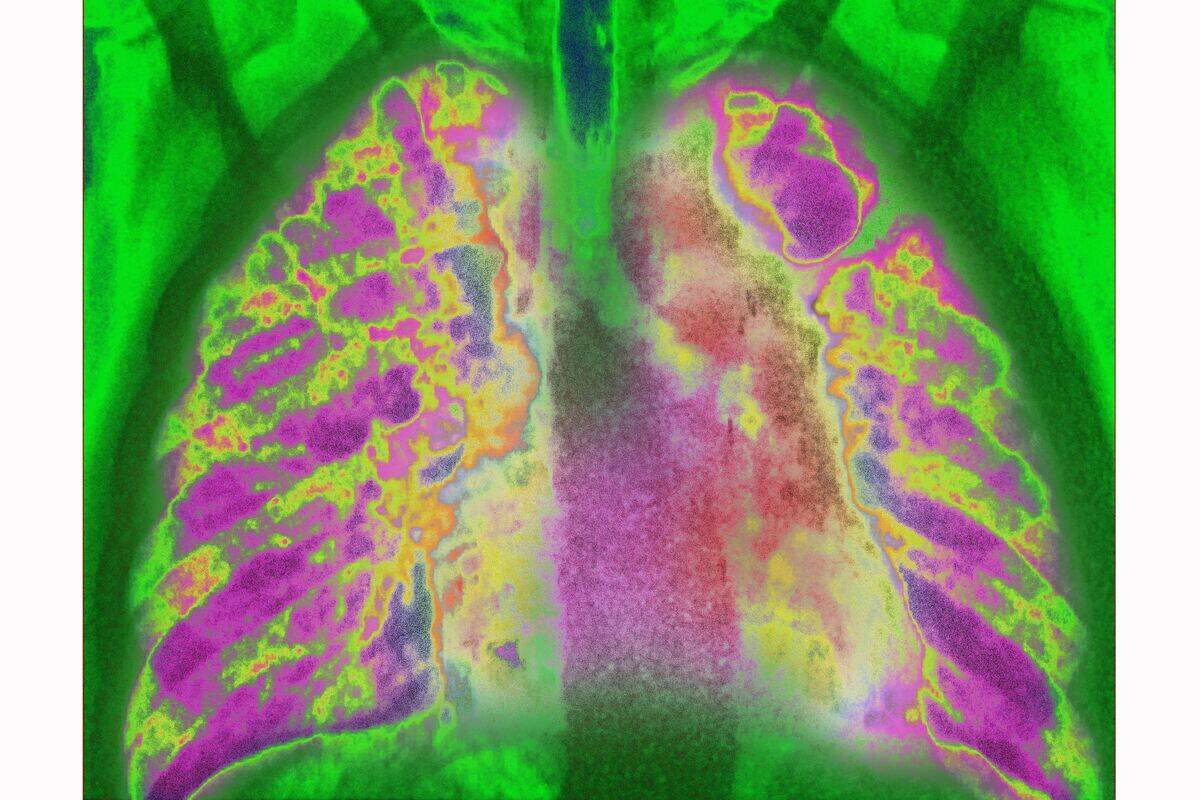 GettyImages-1041926828