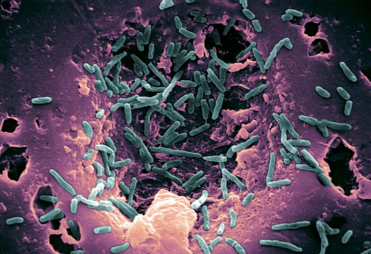 GettyImages-179795841