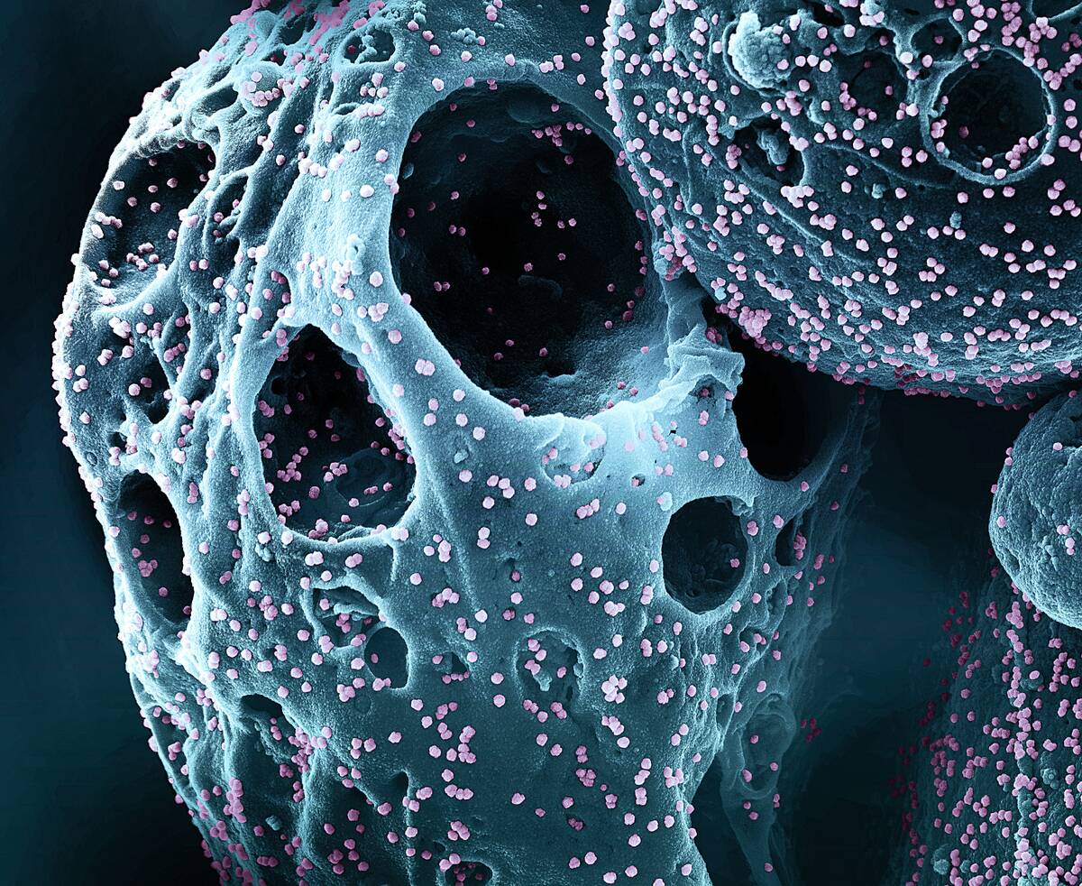 GettyImages-2238305244